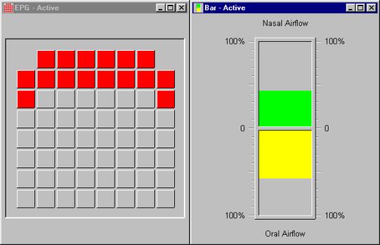 snors+ display panels