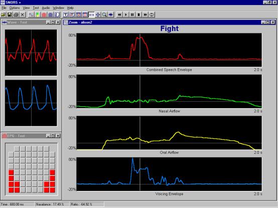 snors+ analysis displays